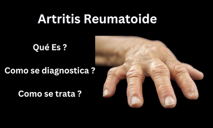 Esas molestias articulares puede ser un Artritis Reumatoide,  que és y como se trata ?